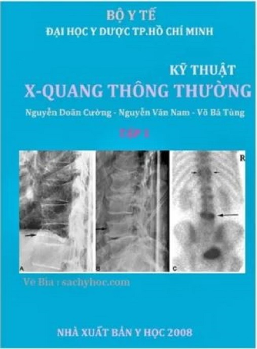 Kỹ Thuật X Quang Thông Thường –