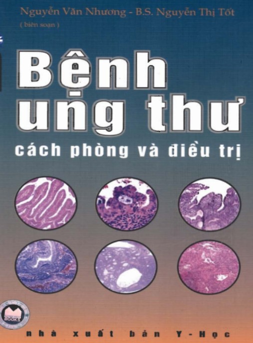 Bệnh Ung Thư Cách Phòng Và Điều Trị