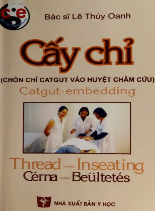Cấy Chỉ (Chôn Chỉ Catgut Vào Huyệt Châm Cứu)