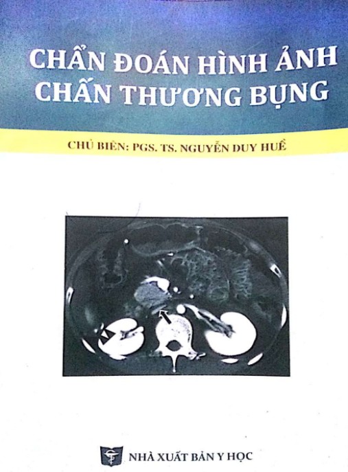 Chẩn Đoán Hình Ảnh Chấn Thương Bụng