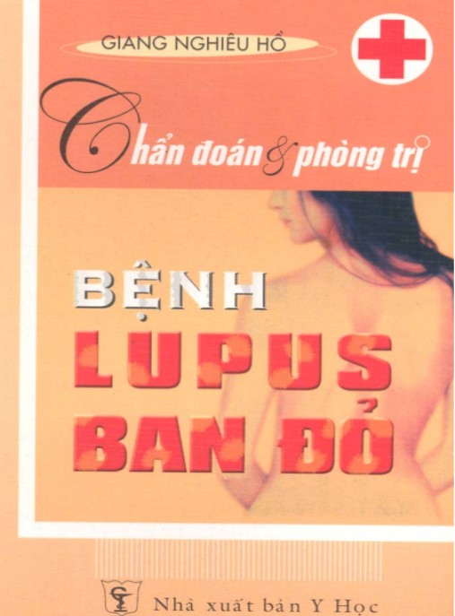 Chẩn Đoán Và Phòng Trị Bệnh Lupus Ban Đỏ