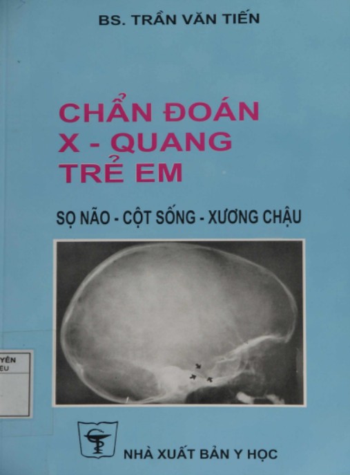 Chẩn Đoán X Quang Trẻ Em