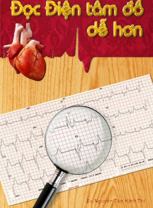 Đọc Điện Tâm Đồ Dễ Hơn