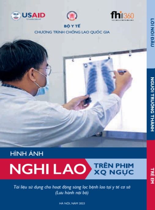 Hình Ảnh Nghi Lao Trên Phim XQ Ngực