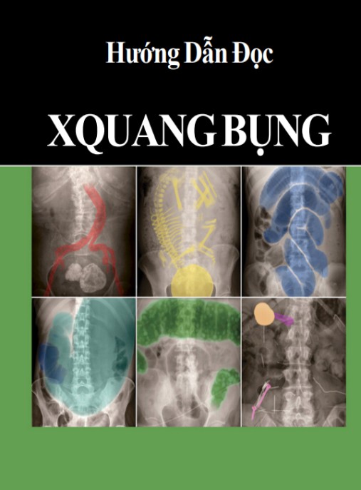 Hướng Dẫn Đọc X Quang Bụng