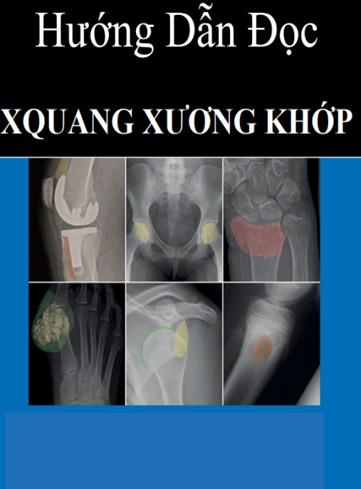 Hướng Dẫn Đọc X Quang Xương Khớp