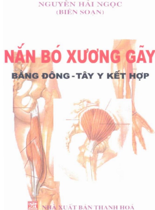 Nắn Bó Xương Gãy Bằng Đông Tây Y Kết Hợp