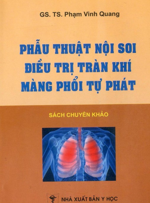 Phẫu Thuật Nội Soi Điều Trị Tràn Khí Màng Phổi Tự Phát