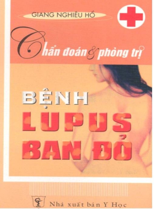 Chẩn Đoán Và Phòng Trị Bệnh Lupus Ban Đỏ