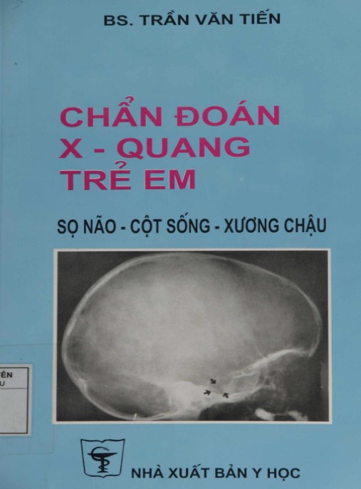 Chẩn Đoán X Quang Trẻ Em